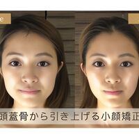 画像1345：Before＆After2