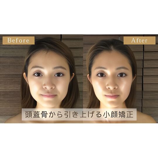 画像1345：Before＆After1