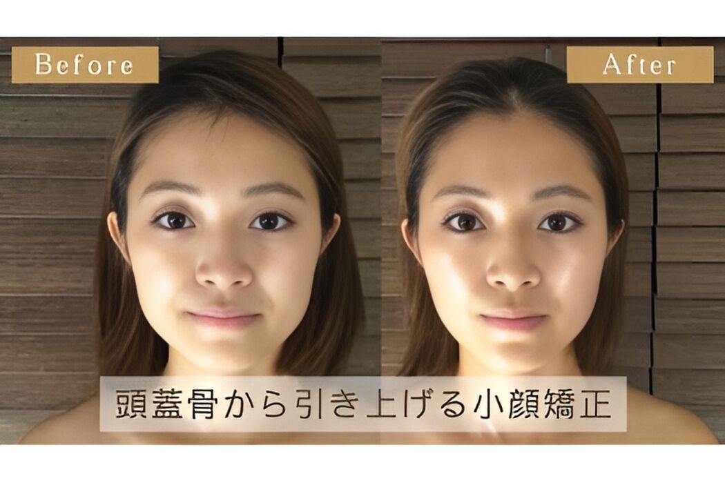 画像1345：Before＆After2