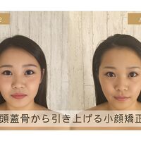 画像1346：Before＆After2