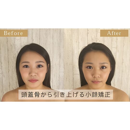 画像1346：Before＆After2