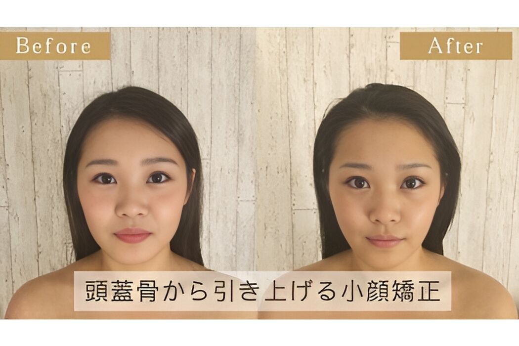 画像1346：Before＆After2